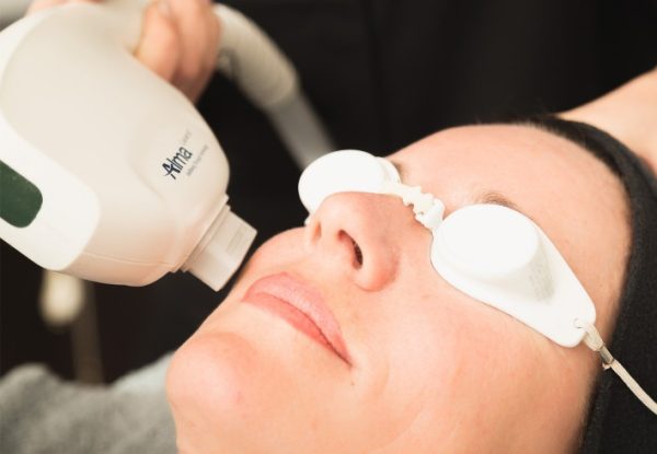 How Do I Prepare for a Laser Skin Resurfacing Treatment?