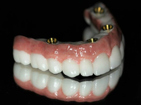 09 How To Teach Dental Supplies Dh Method Of Training