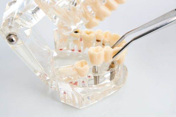 How Long Does It Take To Turn Into A Dentist?